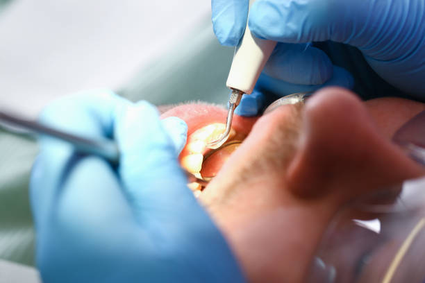 Best Cracked Tooth Emergency Dentist  in Orcutt, CA