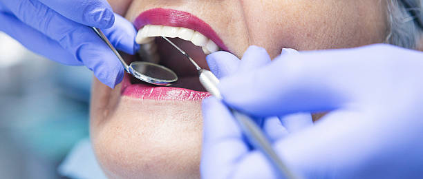 Best Dentist for Tooth Abscess  in Orcutt, CA