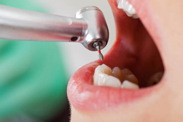 Best Root Canal Emergency Dentist  in Orcutt, CA